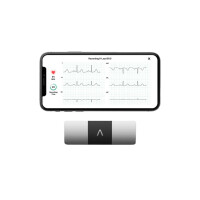 AliveCor KardiaMobile 6L - mobile 6-lead ECG heart monitor