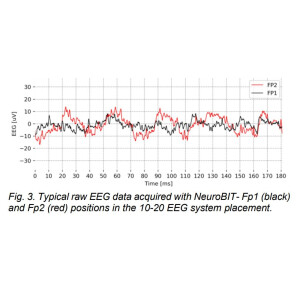 BITalino NeuroBIT Kit für Elektroenzephalographie - EEG-Daten für Schulen Lehre Universitäten