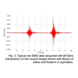 BITalino MuscleBIT BT Kit für die Messung der Elektromyographie EMG für Schulen Lehre Universitäten