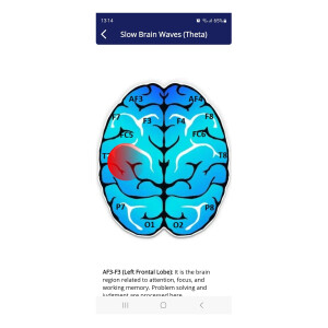 Auto Train Brain Wellness Neurofeedback Softwarelizenz 9 Monate Laufzeit